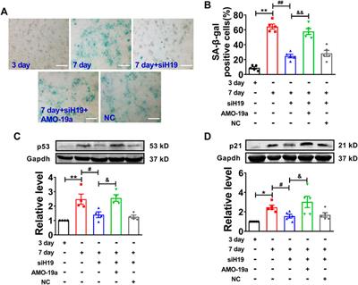 LncRNA-H19 Drives Cardiomyocyte Senescence by Targeting miR-19a/socs1/p53 Axis